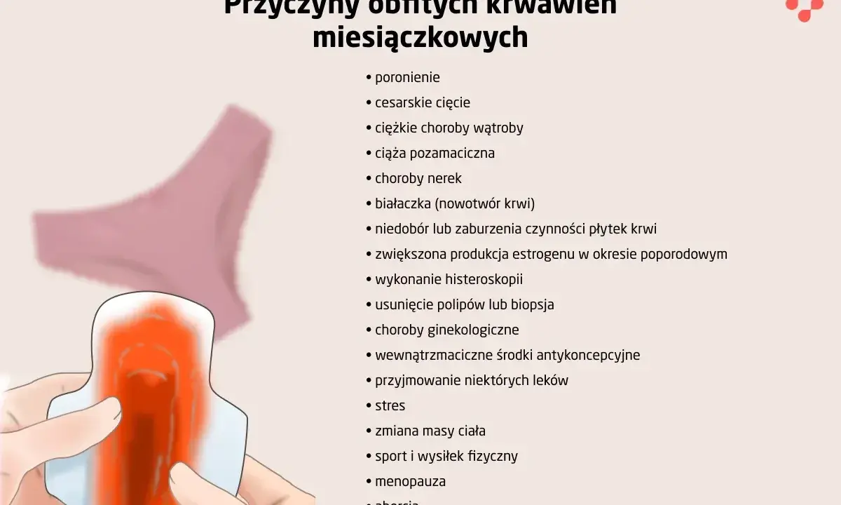 Ilustracja przedstawia przyczyny obfitych krwawień miesiączkowych, np. stres, choroby, poronienie. Długość okresu u kobiety może się różnić.