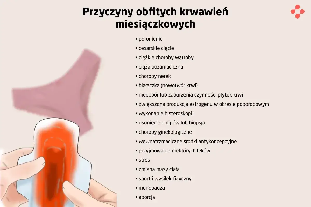 Ilustracja przedstawia przyczyny obfitych krwawień miesiączkowych, np. stres, choroby, poronienie. Długość okresu u kobiety może się różnić.